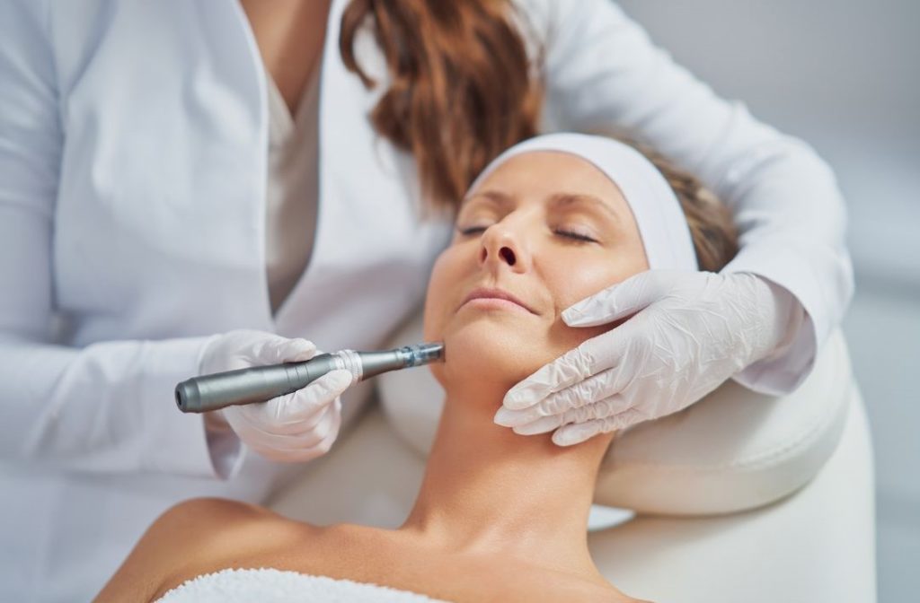 Frau bei Mikroneedling Behandlung für bessere Kollagenproduktion